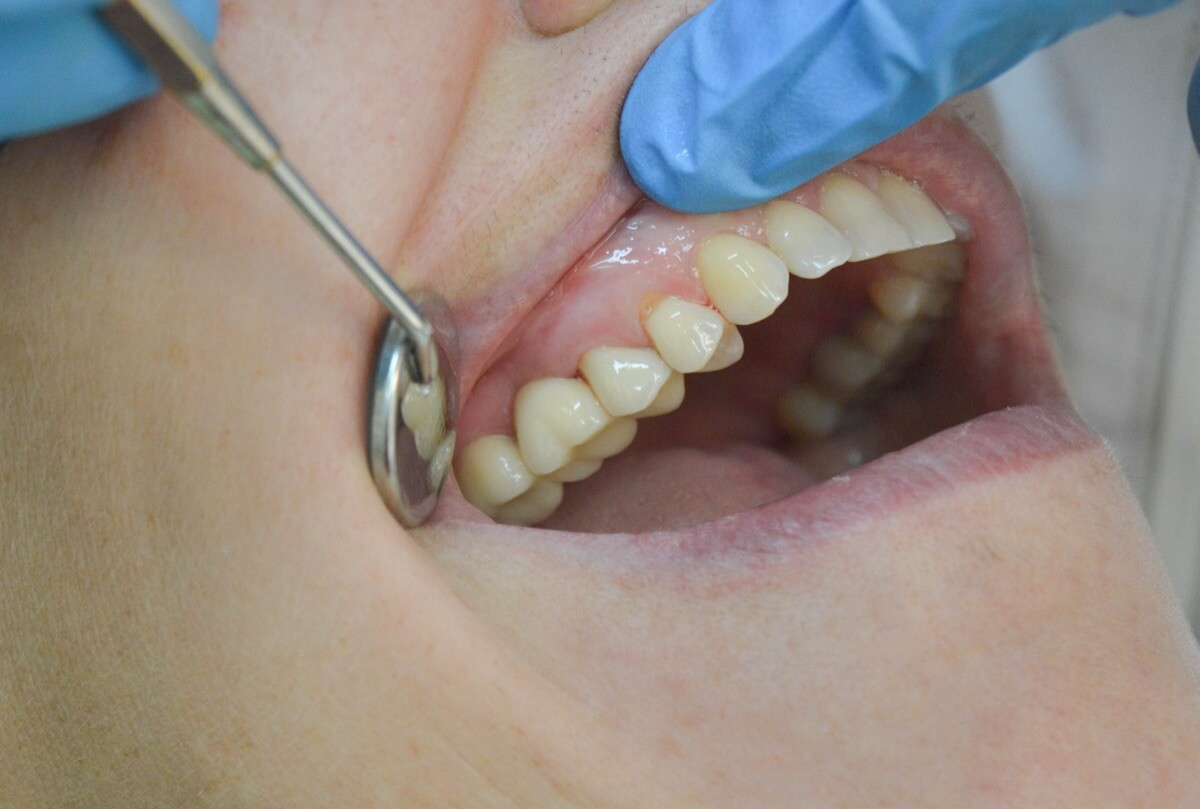 Soins post-opératoires : Un accompagnement personnalisé pour une guérison optimale